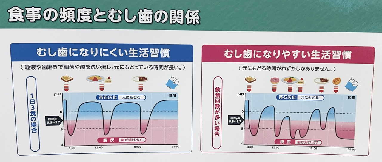 間食と虫歯