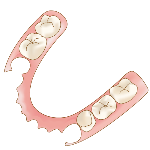 ノンクラスプ義歯について